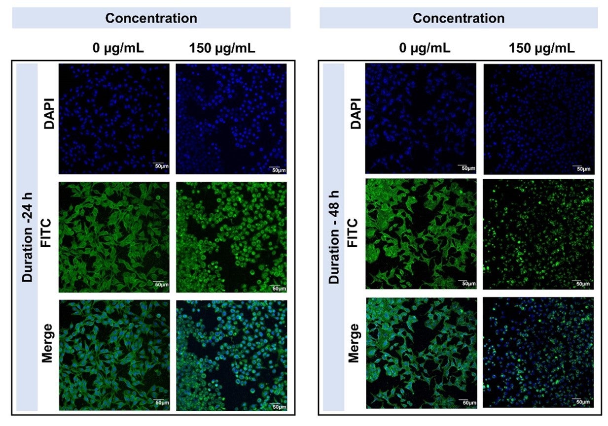 Comparison of lung cancer cells being treated with 0µG/ml, and 150 µG/ml of black cardamom extracts over 24 and 48 hour durations. Lung cancer cells showed distorted morphologies with dichloromethane extract treatment.