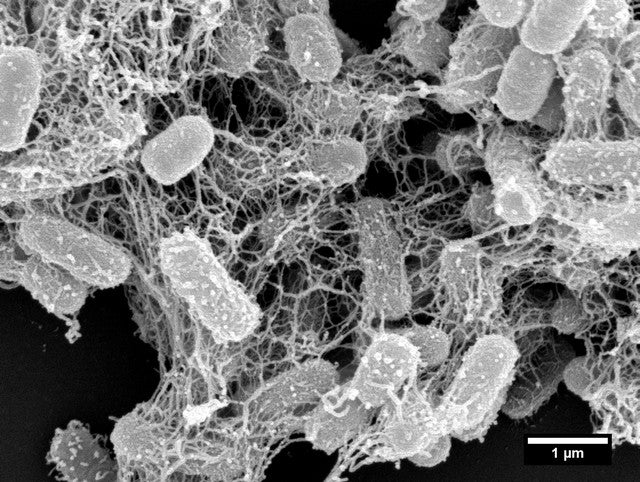 Antimicrobial nanonets for trap-and-kill treatment of antibiotic-resistant bacteria