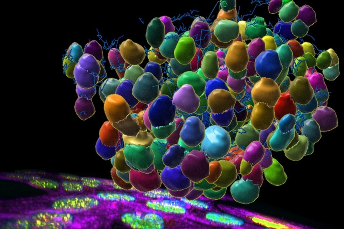 Cancer cells grip and tear their way into new tissues